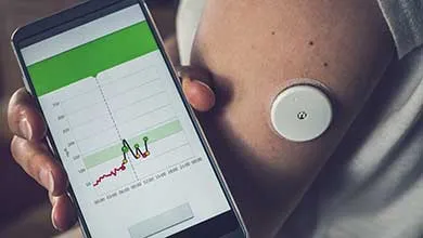 A white, circular continuous glucose monitor on a person's upper arm tracks blood glucose levels, displayed on a smartphone.